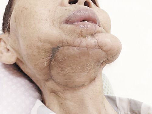 槟榔国际公认的软毒品,软性毒品槟榔定时炸弹事件