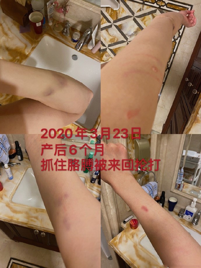 张培萌被控诉家暴,张培萌妻子回应家暴