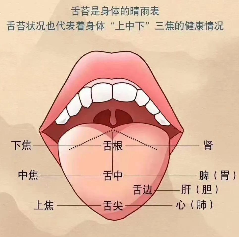 中医祛寒湿最好的方法,中医寒湿阻络怎么治疗