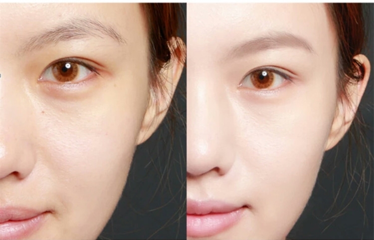 肤色蜡黄的素颜霜,脸蜡黄用素颜霜有用吗