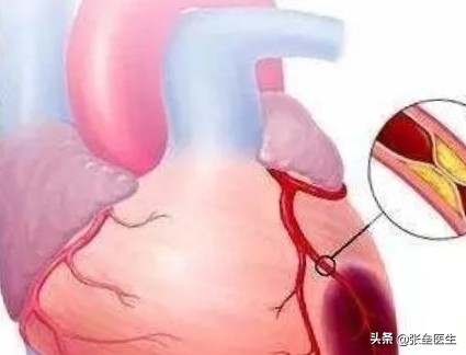 感觉心脏不好基本检查有哪些,总感觉心脏有病还检查不出来