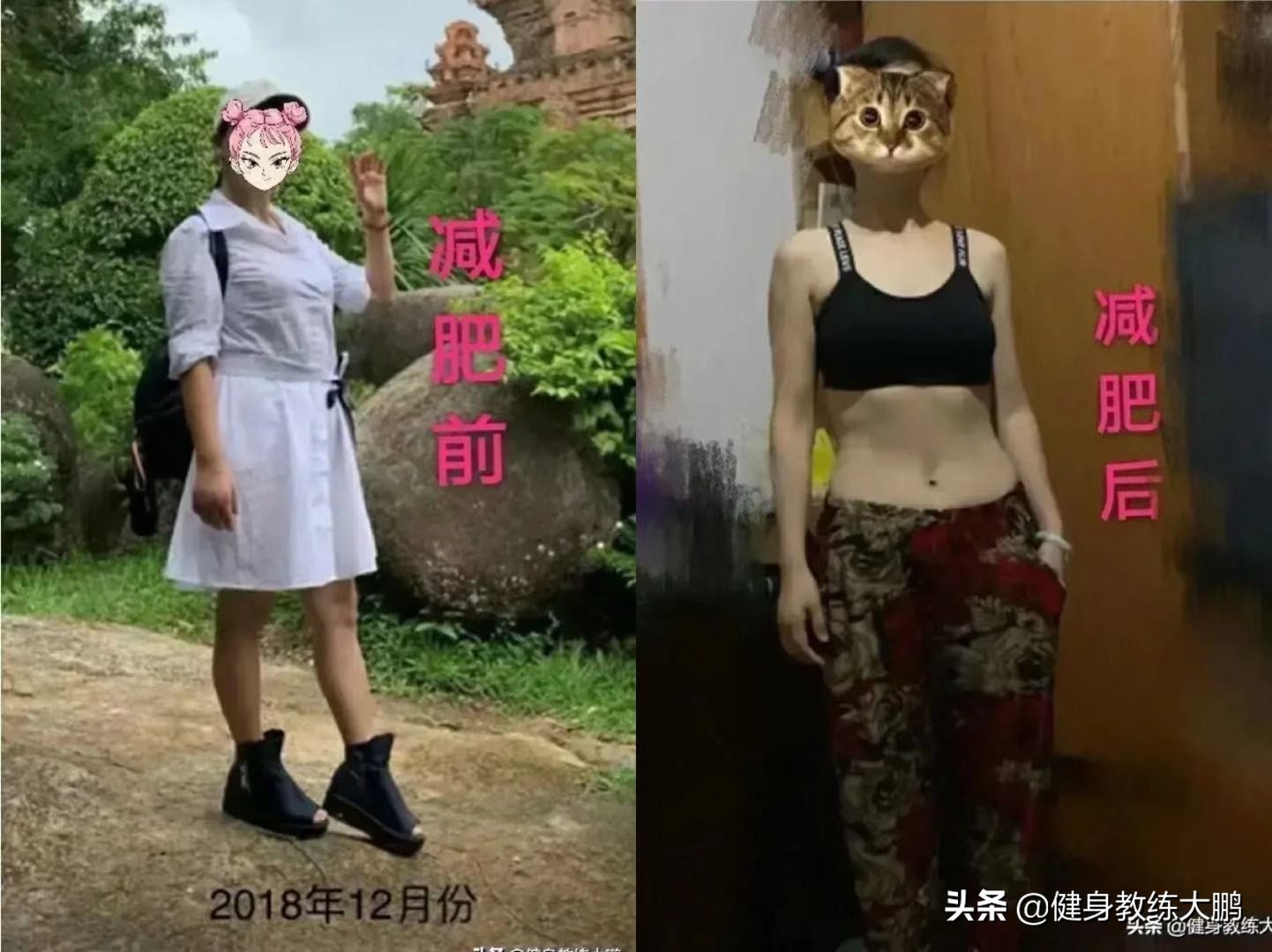 大胖子瘦下来皮松弛,胖子减下来后肚子上皮肤松弛
