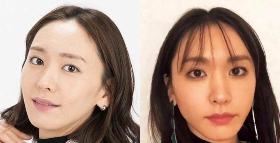 头发的长短稀疏决定衰老的速度,头发稀少又白让人一下子老了几岁