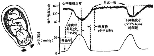 孕妈妈需要经历什么,从怀孕到生需要做多少次产检