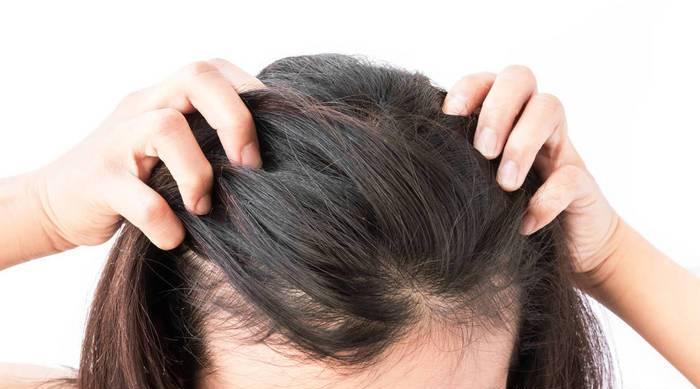 头皮总是长疙瘩或脓包怎么办,头皮长疙瘩和脓包是什么原因