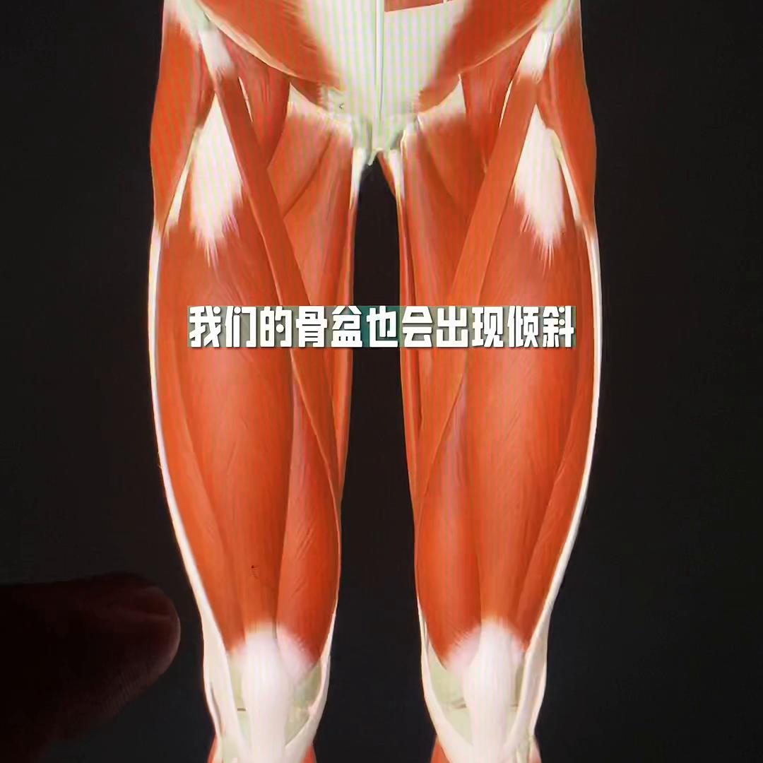 体态歪斜矫正,体态歪斜面部变形