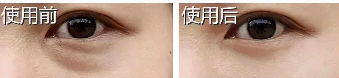 雅诗兰黛小棕瓶家族，从肌底修护开始让肌肤由内而外透亮发光