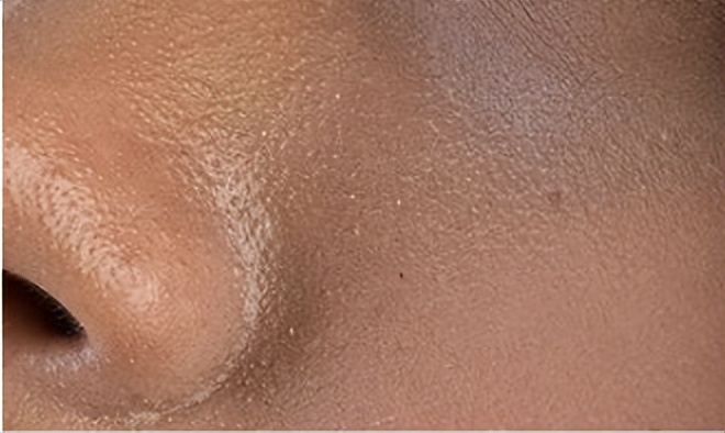 去角质慕斯是不是智商税,蔓柚护肤来揭秘