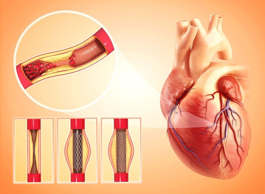 振华重工称霸全球,突破垄断令西方震惊
