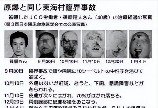 有关日本核辐射的最新情况,日本核辐射的恐怖之处