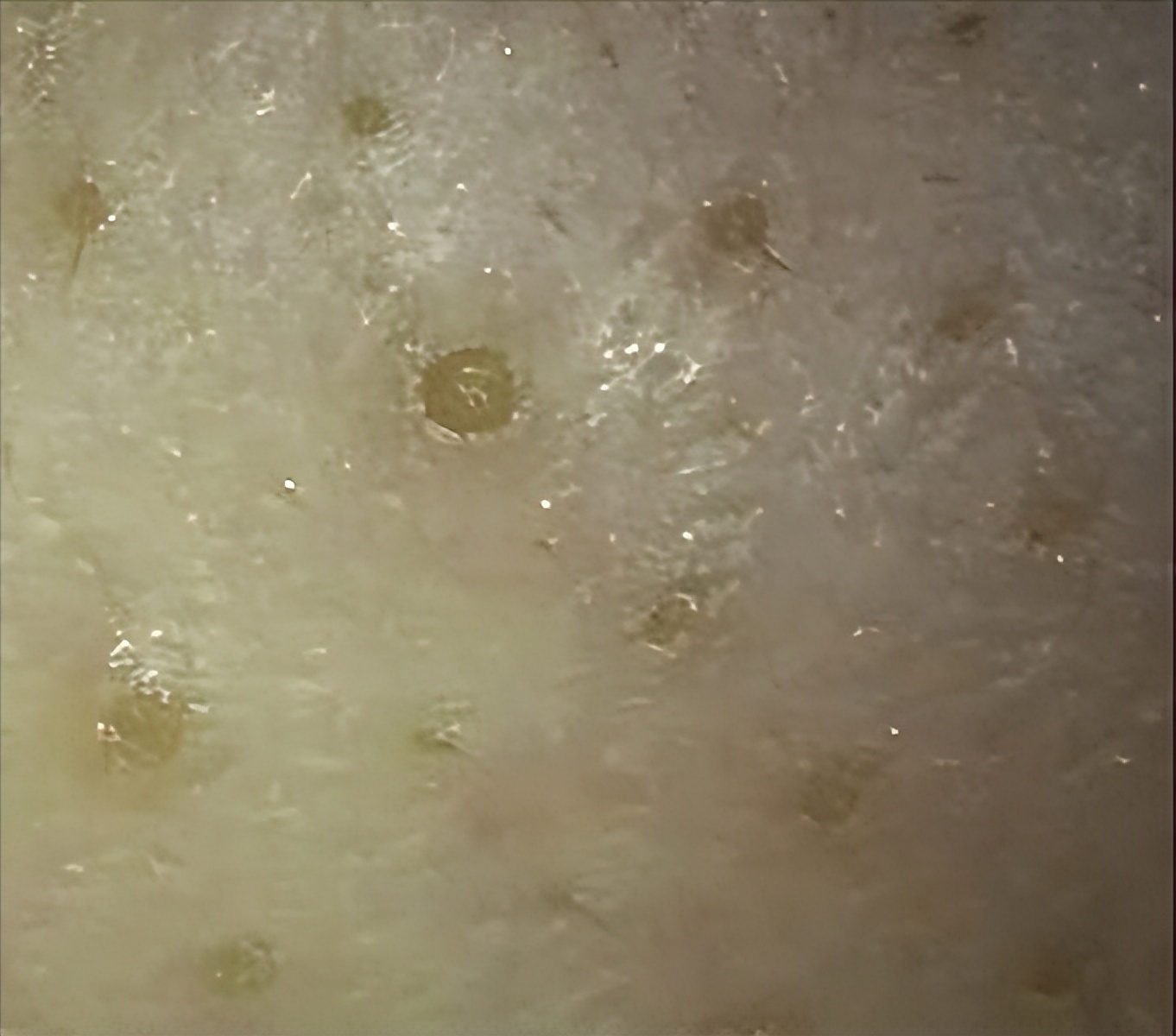 毛孔堵塞怎样才能疏通毛孔,身上毛孔堵塞不出汗怎么疏通毛孔