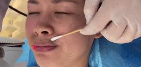 嘴唇薄变丰满,嘴唇变凸变丑怎么办