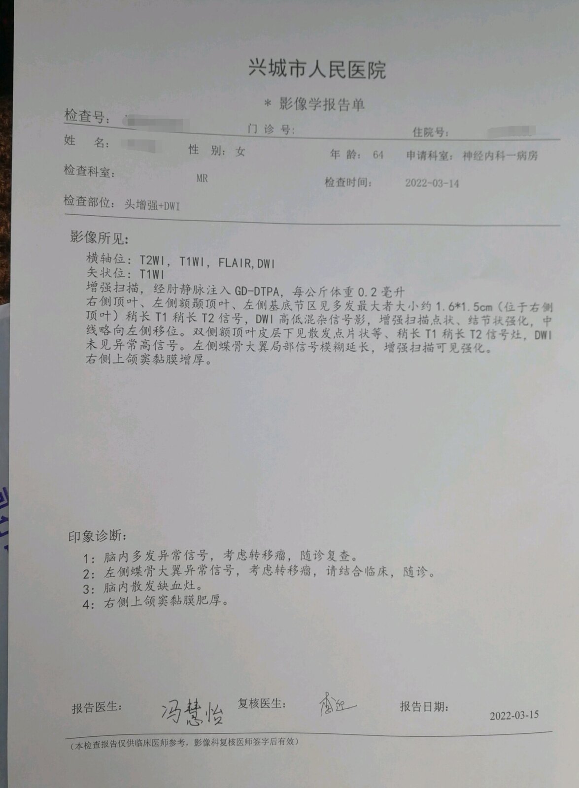 肺癌脑转移出现脸肿怎么回事,刘懿博士肺癌晚期症状