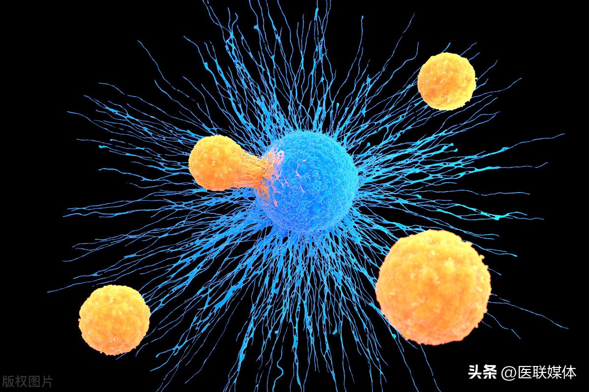 白头发是癌症的前兆吗,为什么白头发越多越不容易得癌症