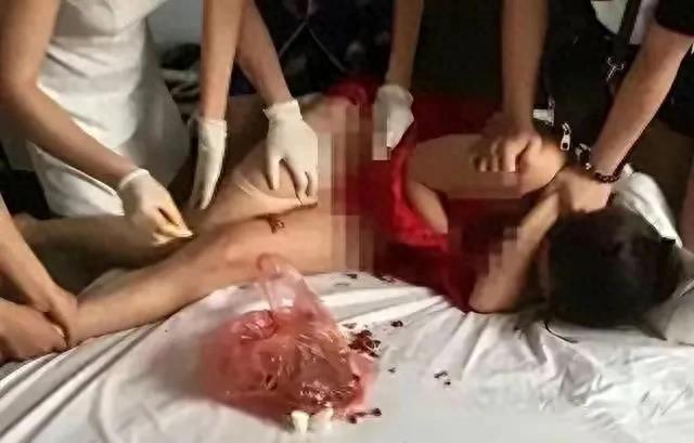 原配扒光小三拍摄私密照并游街并往*处私**塞辣椒，被判刑八个月