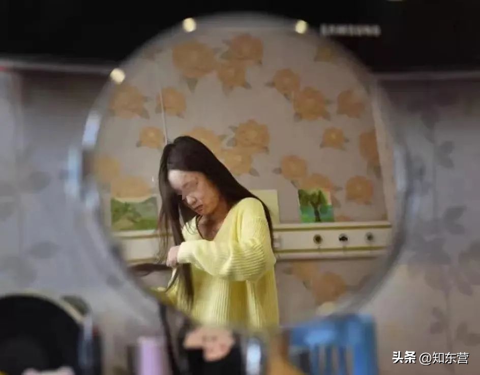 遭男友泼汽油烧伤的女孩现状,被富二代泼油毁容的女孩