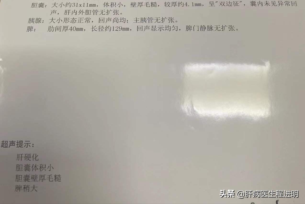 再重的肝病也有希望!最好的礼物就是康复