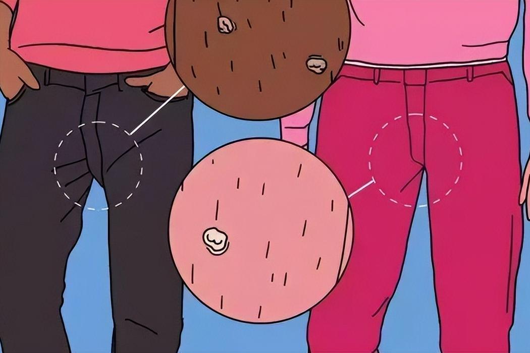 “外阴癌”癌前病变?提醒女性:出现这4种异常，要引起注意