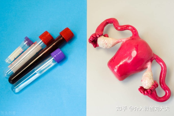 CT引导下介入硬化治疗卵巢巧克力囊肿临床研究招募