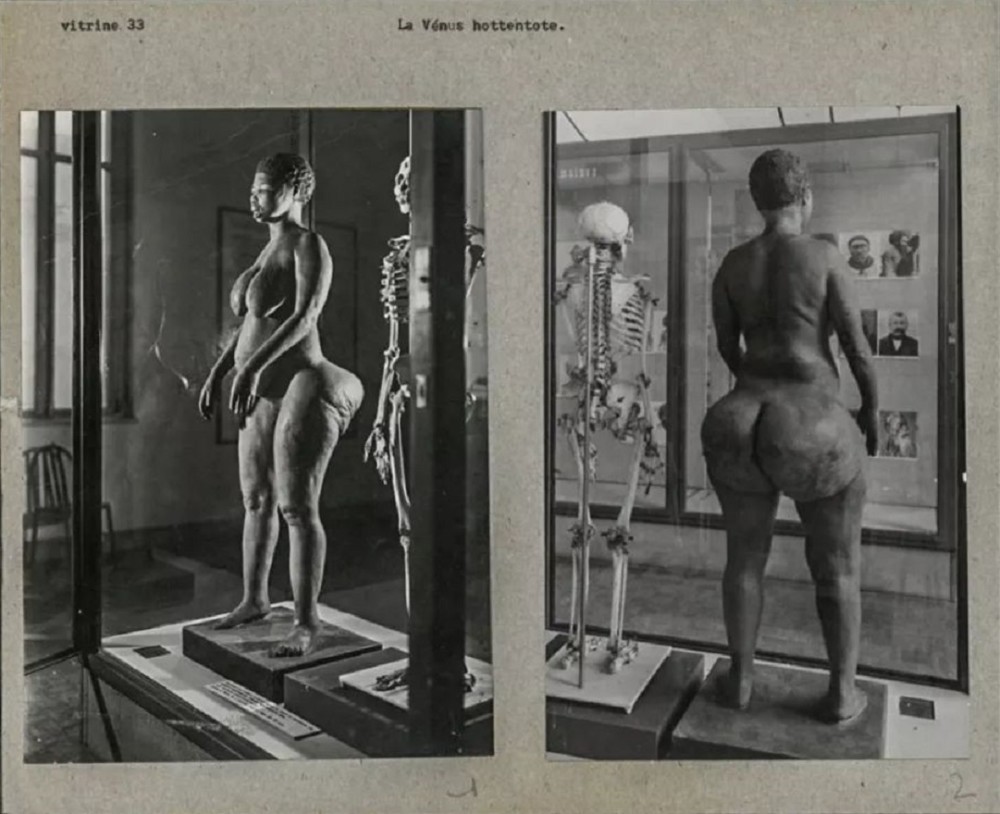 南非少女巴特曼照片,南非萨拉巴特曼标本