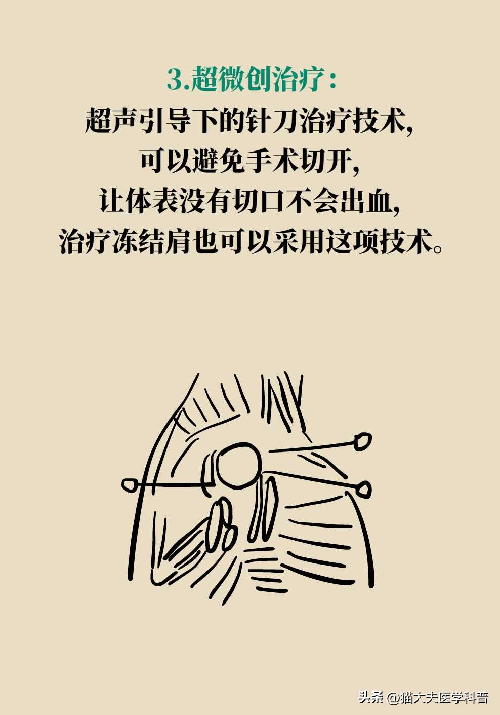 肩膀痛抬胳膊就痛是什么原因,肩膀疼痛做爬墙锻炼