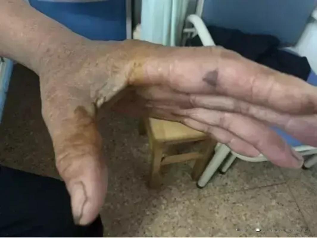 还敢随便杀蛇吗？被砍下的蛇头还能咬人，难道蛇死了还会*仇报**？