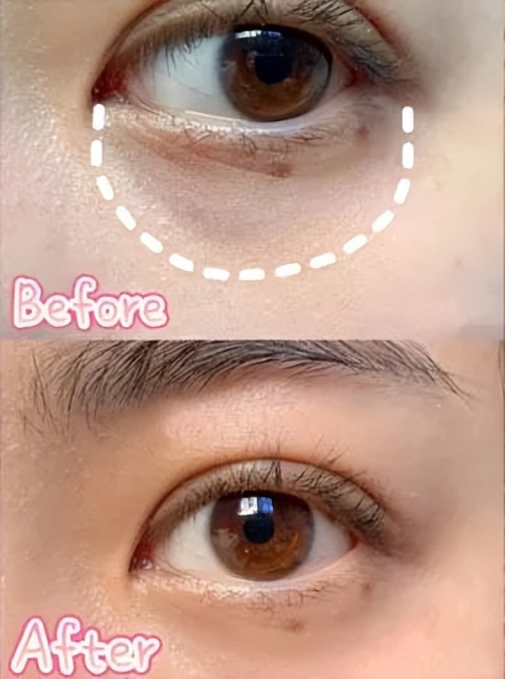 新款兰蔻小黑瓶眼霜里面有细闪吗,兰蔻菁纯淡纹黑眼圈眼霜