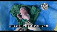 婴儿发生心跳呼吸骤停时,婴儿刚出生心脏就出现骤停