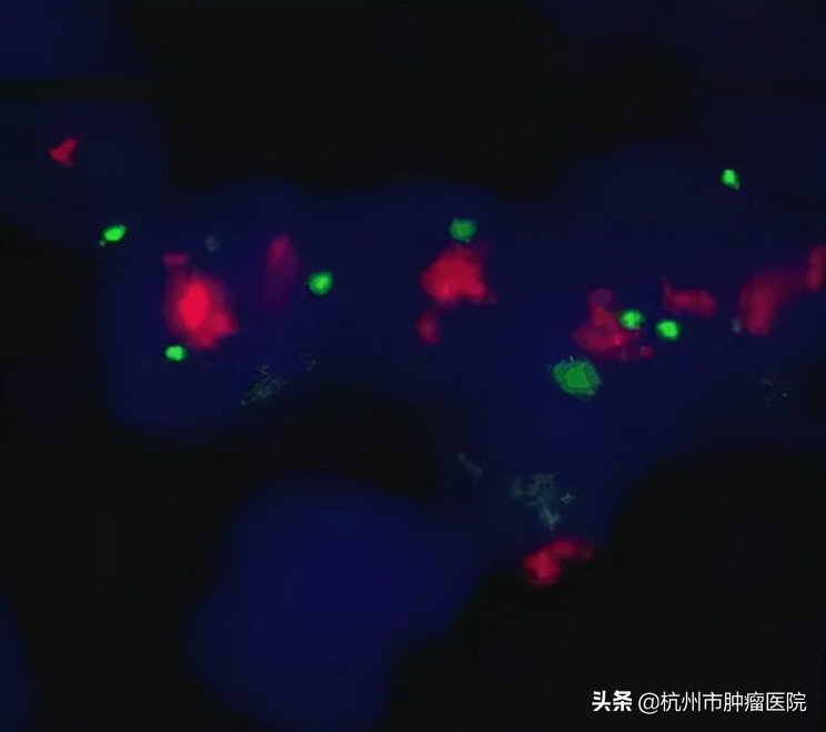 健康科普体检报告你会看吗,健康医学科普报告