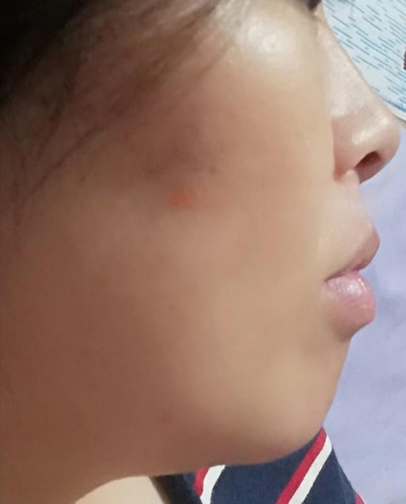 整牙亲身经历分享一下,整牙的经历分享