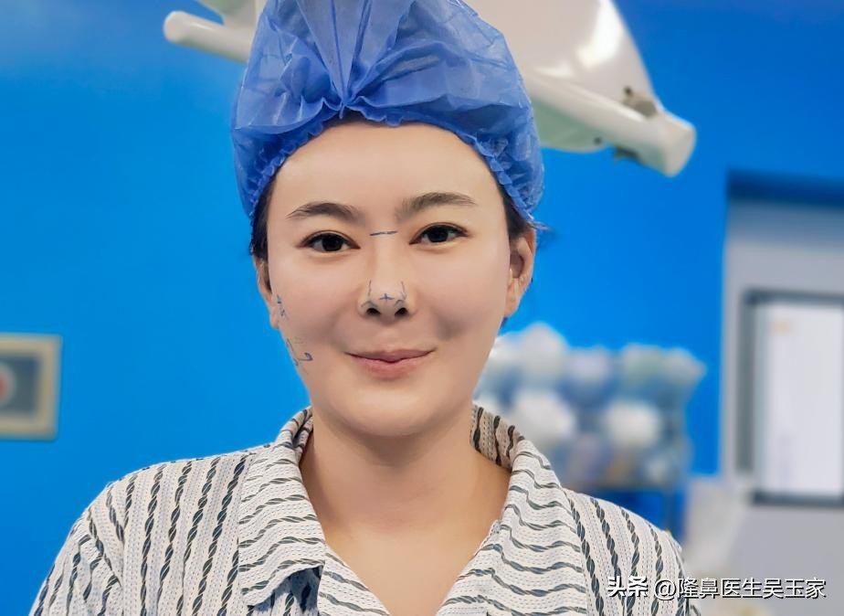 四十岁鼻基底填充玻尿酸,什么人适合做鼻基底填充