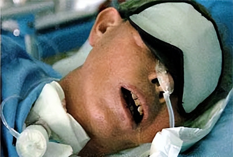 印度喝假酒导致100多人中毒,印度假酒中毒事件看法