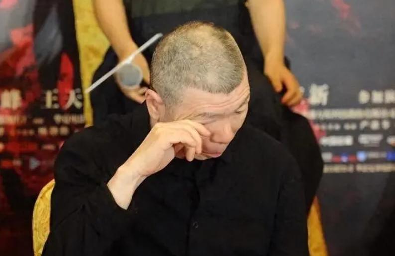 冯小刚的白癜风能治吗,冯小刚患白癜风视频