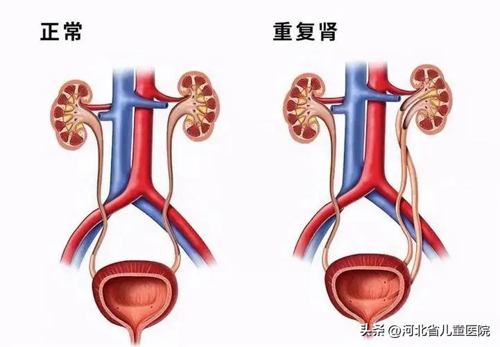 六岁男孩早上起来总是裤子湿一点,奇特的裤子儿童