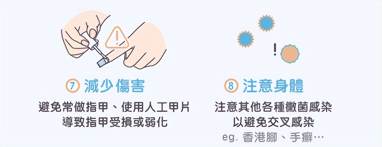 怎样避免灰指甲传染给孩子,灰指甲容易传染给别人吗