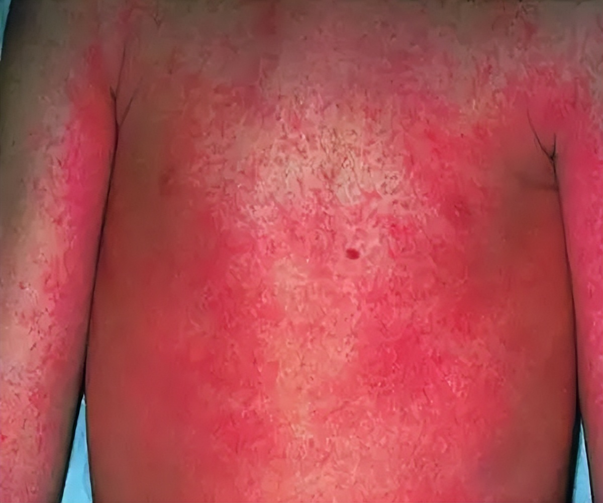 小孩的舌头出现小红点点,小儿舌头的各种症状如何解决