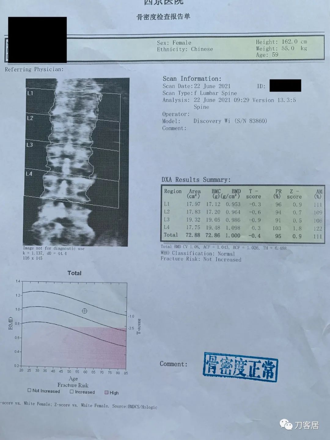 髋部疼，小腿肚胀、抽筋，折腾了5年没效果，能用阿仑膦酸钠吗？