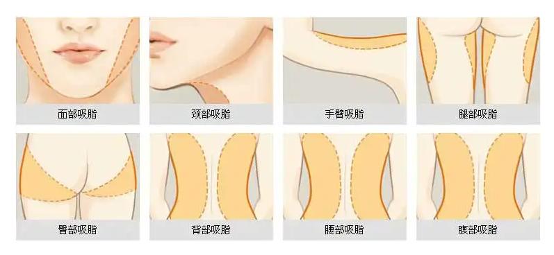 九院韦敏隆鼻相关科普第二期,九院韦敏手术案例