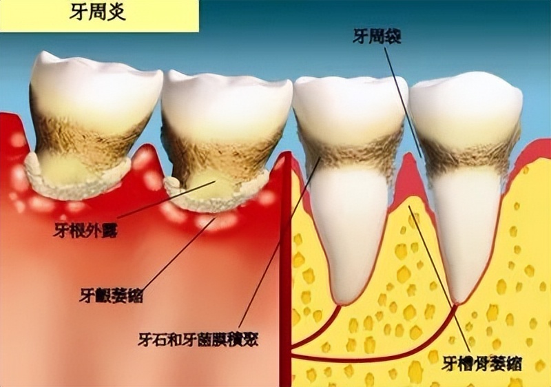 什么样的牙齿无药可救了,常见的牙齿的疾病和处理方法