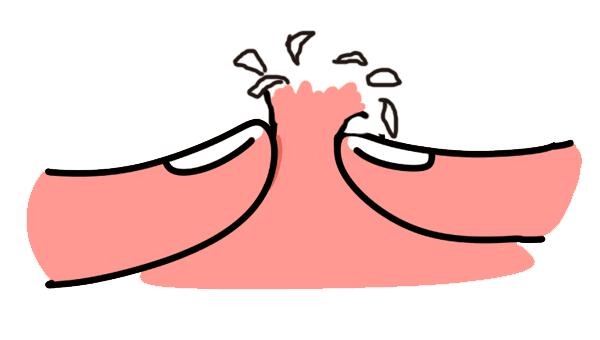 春季易发哪些皮肤病,秋冬常见皮肤病有哪些