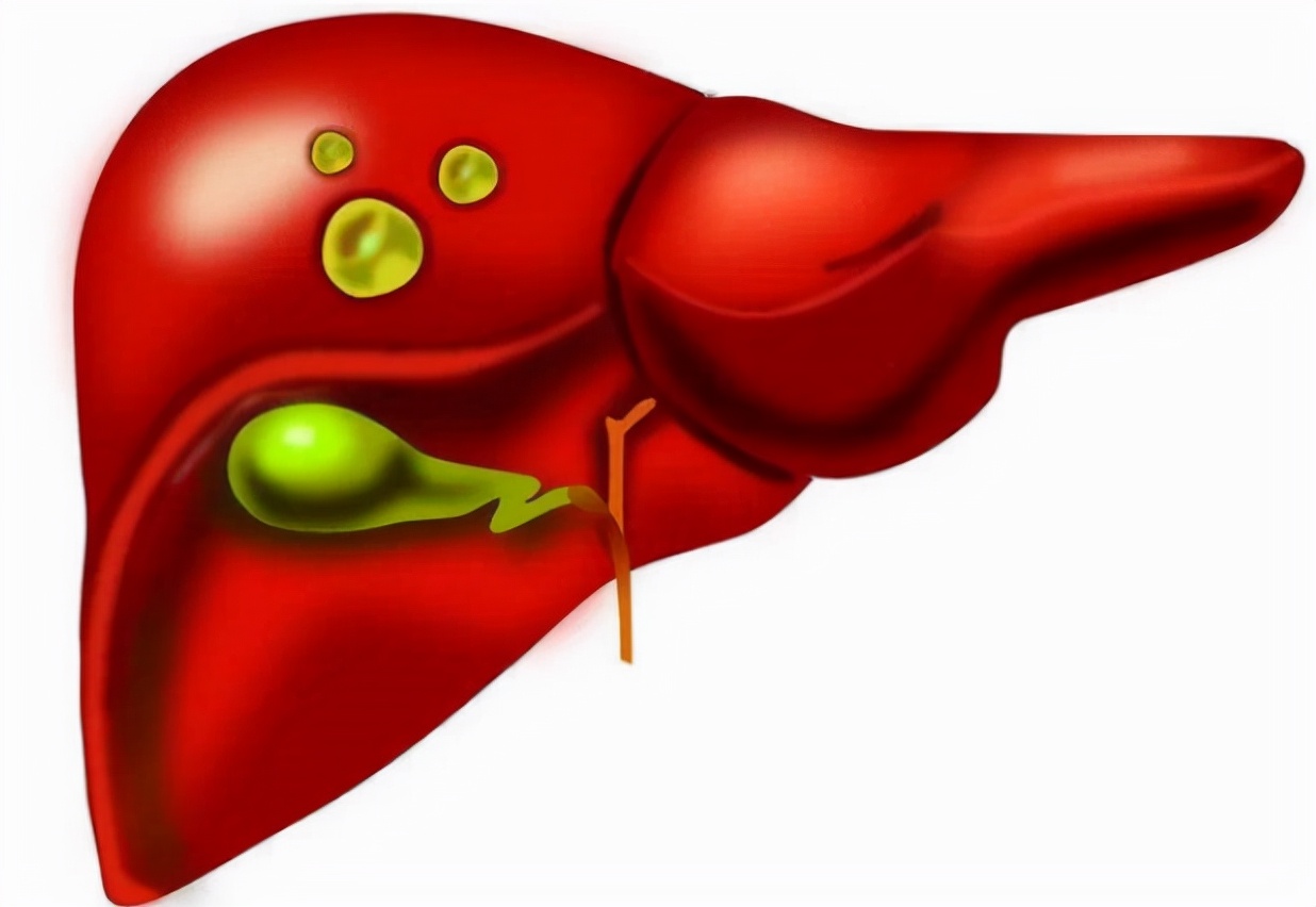 医生说有个囊肿是怎么回事,医生处理囊肿