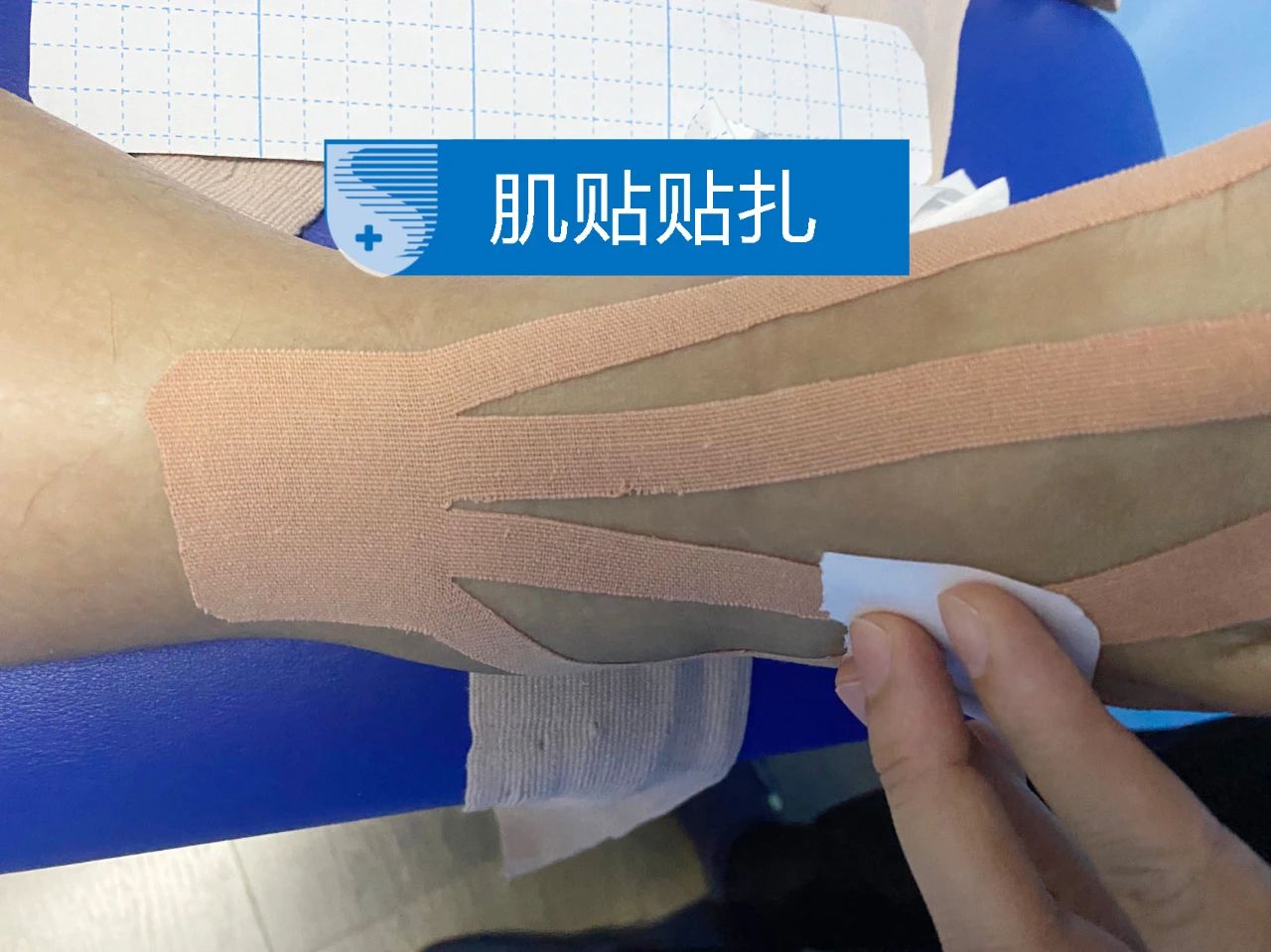 崴脚十年了还是有点肿经常会疼,崴脚了没有肿但是隐隐作痛