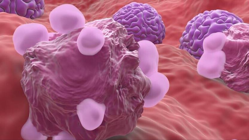 女外阴瘙痒是什么原因引起的,女外阴瘙痒一般是什么原因引起的