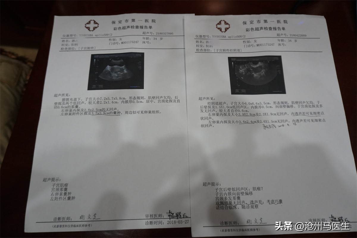 中医子宫腺肌症痛经,中医腺肌症痛经最简单的止痛方法
