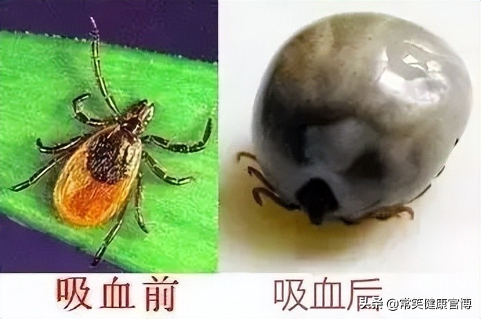 又到高发季外出警惕这种夺命虫,警惕这些“夺命虫”