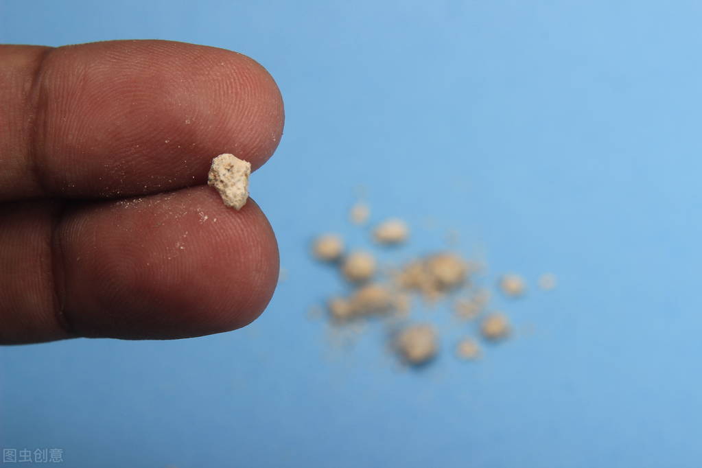 女子长期腰痛一查结石塞满肾脏,女性突然腰痛是不是有结石