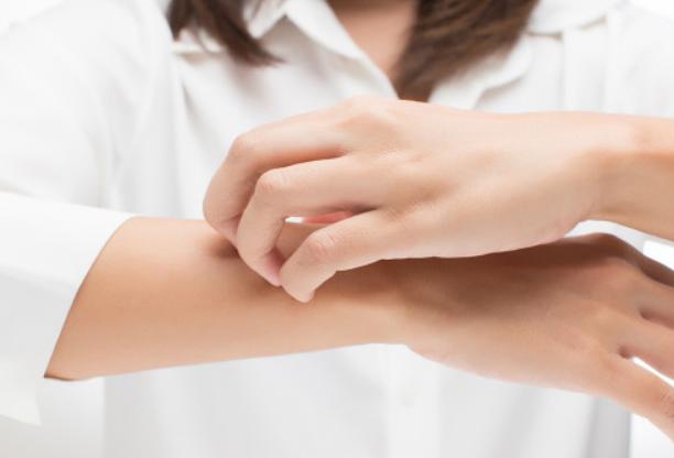 一到冬天皮肤干燥掉皮屑像下雪,一到冬天皮肤干燥皮屑满天飞