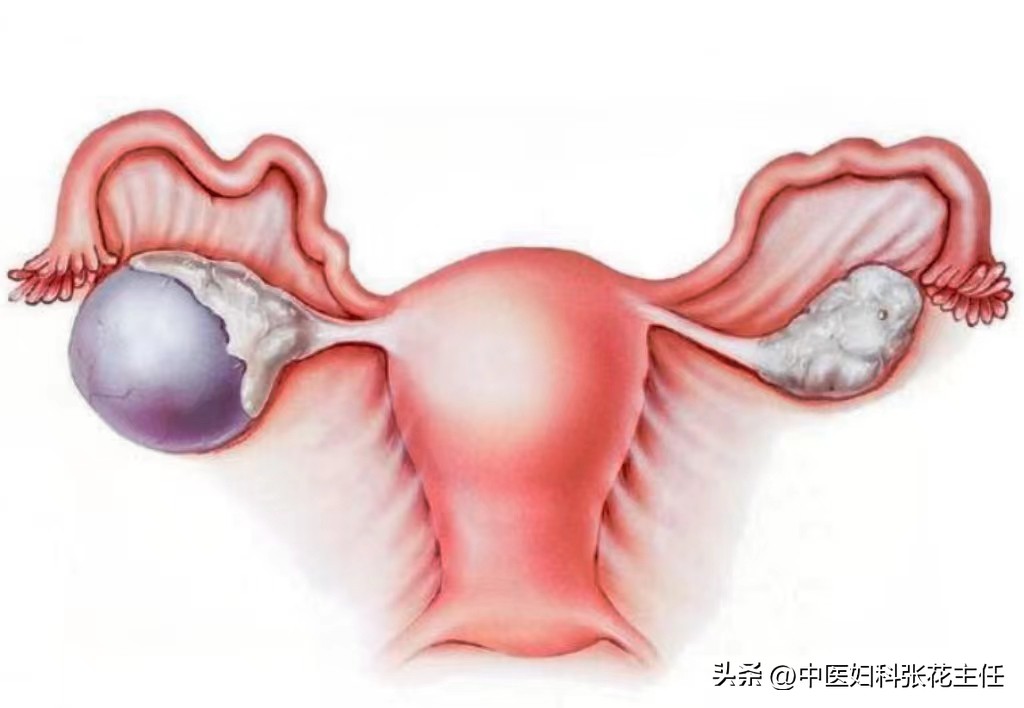 囊肿可以随便切吗,生孩子可以顺便切除囊肿吗