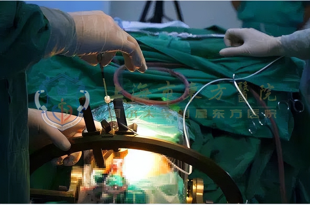 精神分裂症恢复最好的情况是怎样,儿童精神分裂症能治愈吗恢复好吗