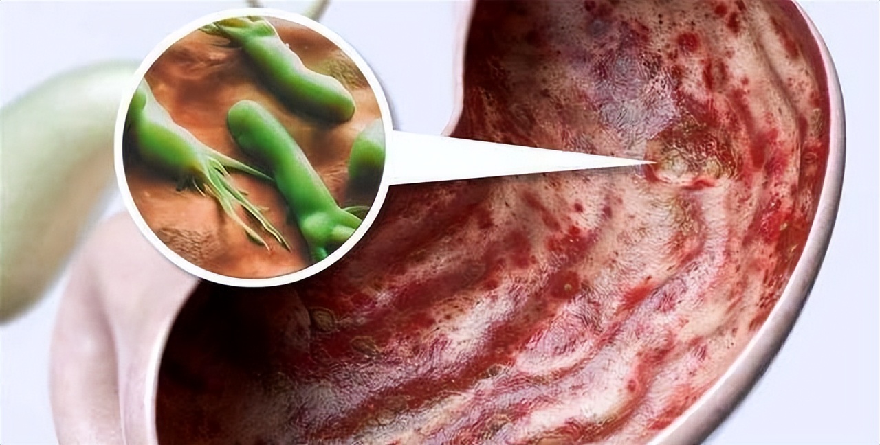 “阿莫西林”要认清，只对这5种病有效，乱用、滥用或会引火烧身